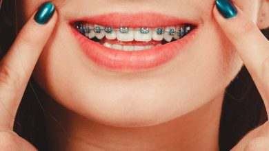 Oyster Bay Braces: Embracing the Future of Orthodontic Care