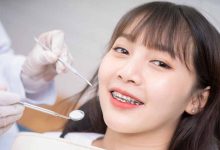 Unlocking Smiles: The Role of Braces Specialists in Transforming Dental Health