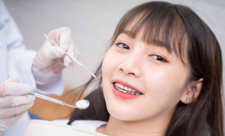 Unlocking Smiles: The Role of Braces Specialists in Transforming Dental Health