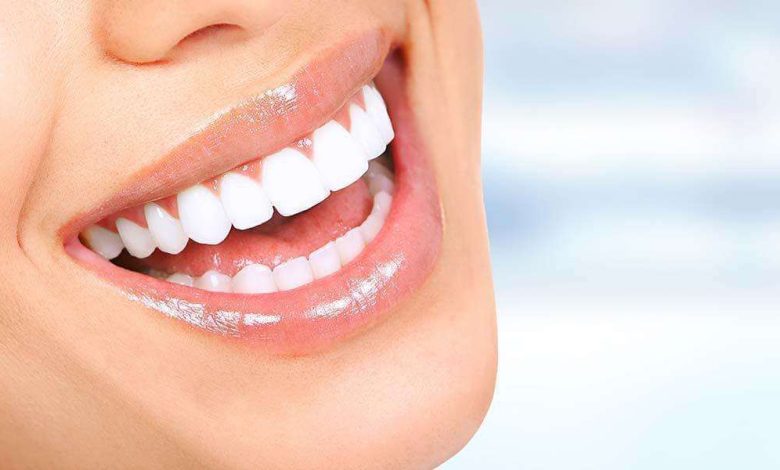 invisalign in Abu Dhabi