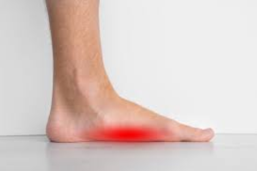 Understanding Lateral Foot Pain Treatment: A Comprehensive Overview